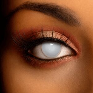 Close-up of a human eye wearing a white blind contact lens, featuring a solid milky-white iris that completely obscures the natural eye colour.